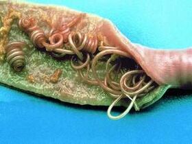 Die Ursachen von Parasiten im menschlichen Körper