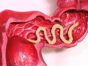 Parasiten im menschlichen Körper, weil sie erscheinen