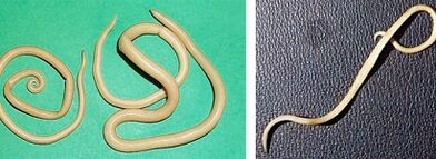 welche Parasiten eine Person haben kann