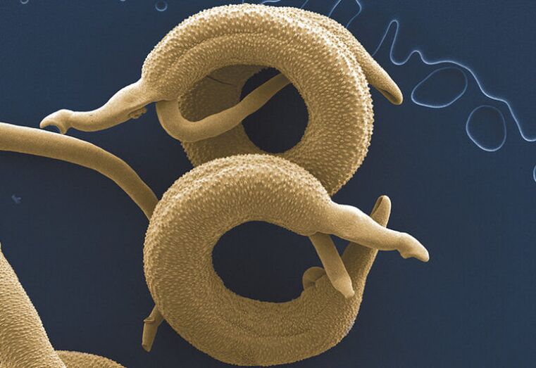 Parasiten, die im menschlichen Körper leben