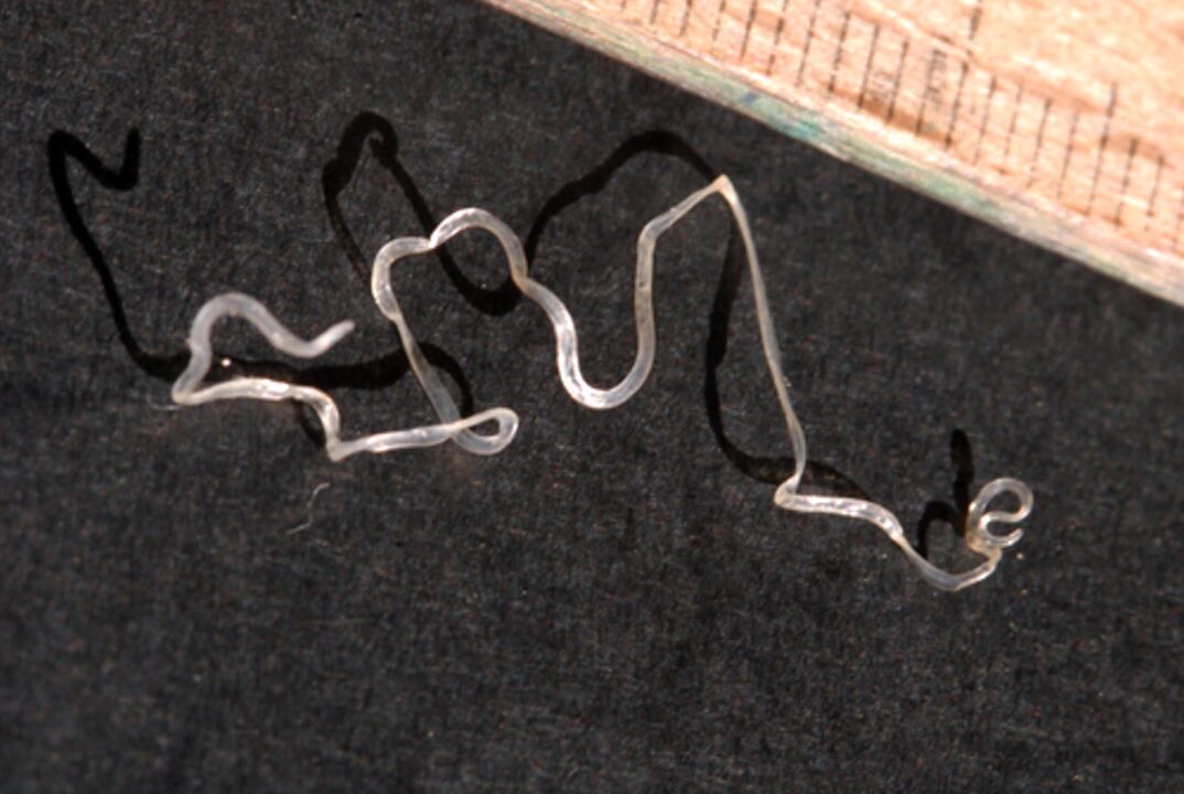 Herzwurm im Körper von Kindern