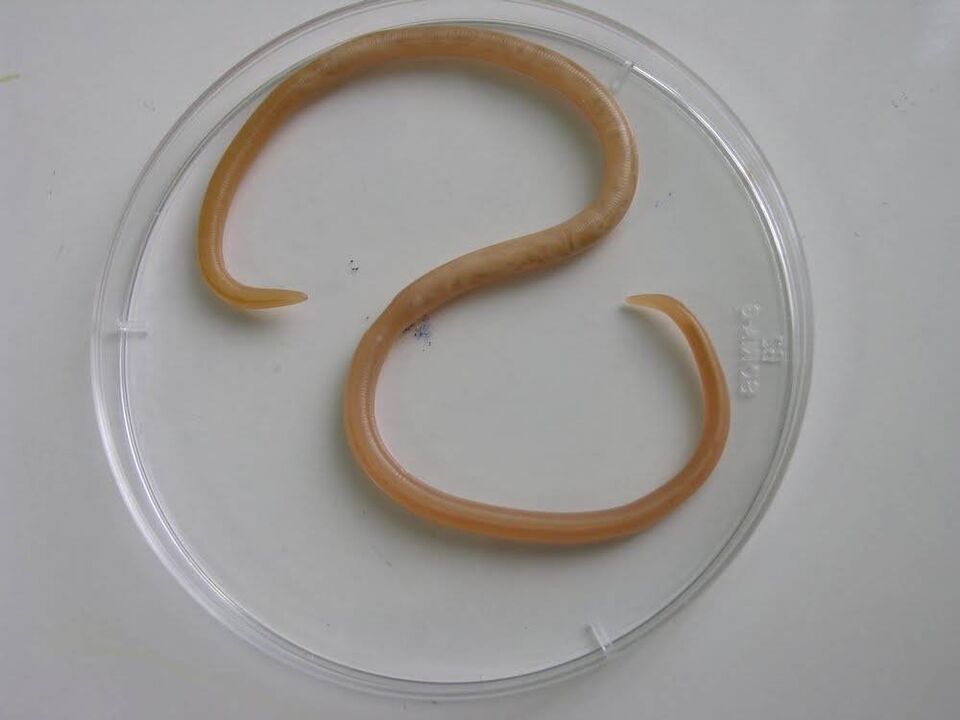 Wie Parasiten bei Kindern aussehen